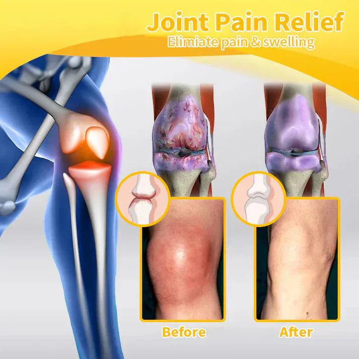 šTAILEDEN⢠Bee Venom Joint Repair GelšØāāļøApproved by the Australian Orthopedic Association (AOA)