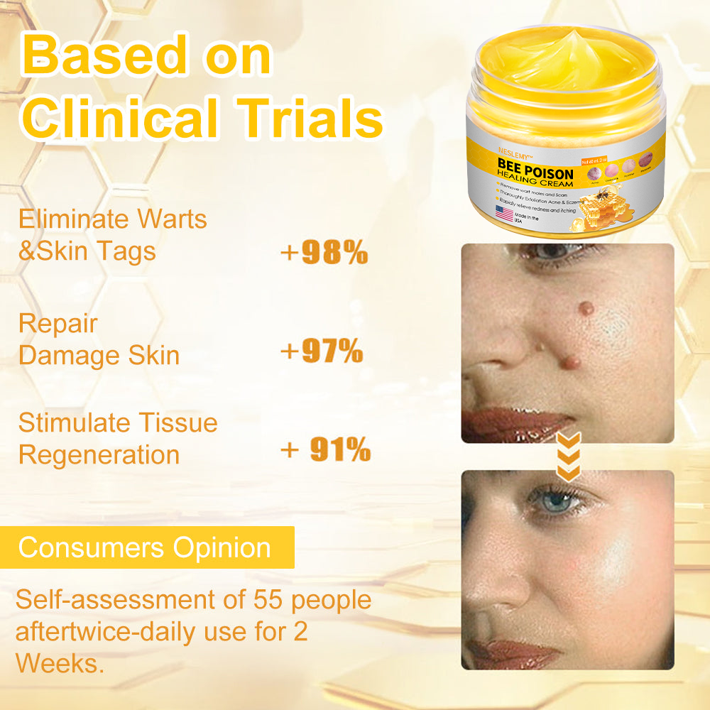 NESLEMY™ Bee Venom Skin Cream(👨⚕AAD Recommended),for Remove Warts, Acne and Scars
