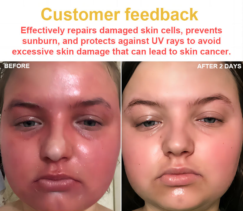 NESLEMY™ Bee Venom Skin Cream(👨⚕AAD Recommended),for Remove Warts, Acne and Scars