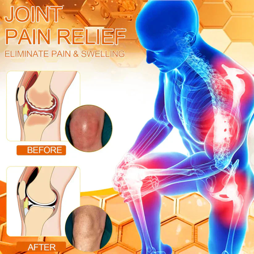šTAILEDEN⢠Bee Venom Joint Repair GelšØāāļøApproved by the Australian Orthopedic Association (AOA)