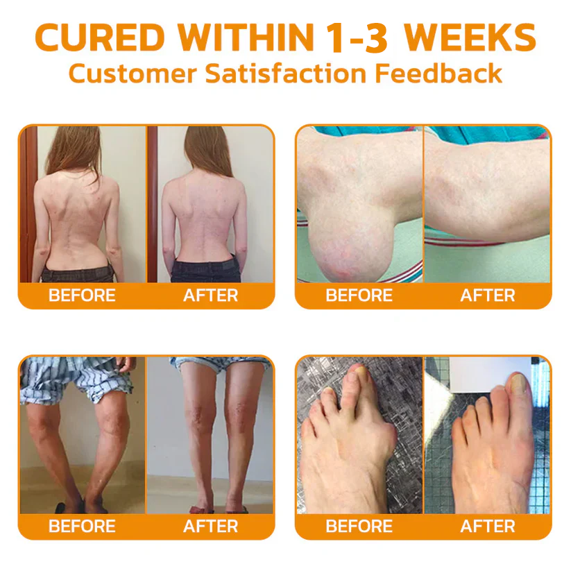 šTAILEDEN⢠Bee Venom Joint Repair GelšØāāļøApproved by the Australian Orthopedic Association (AOA)