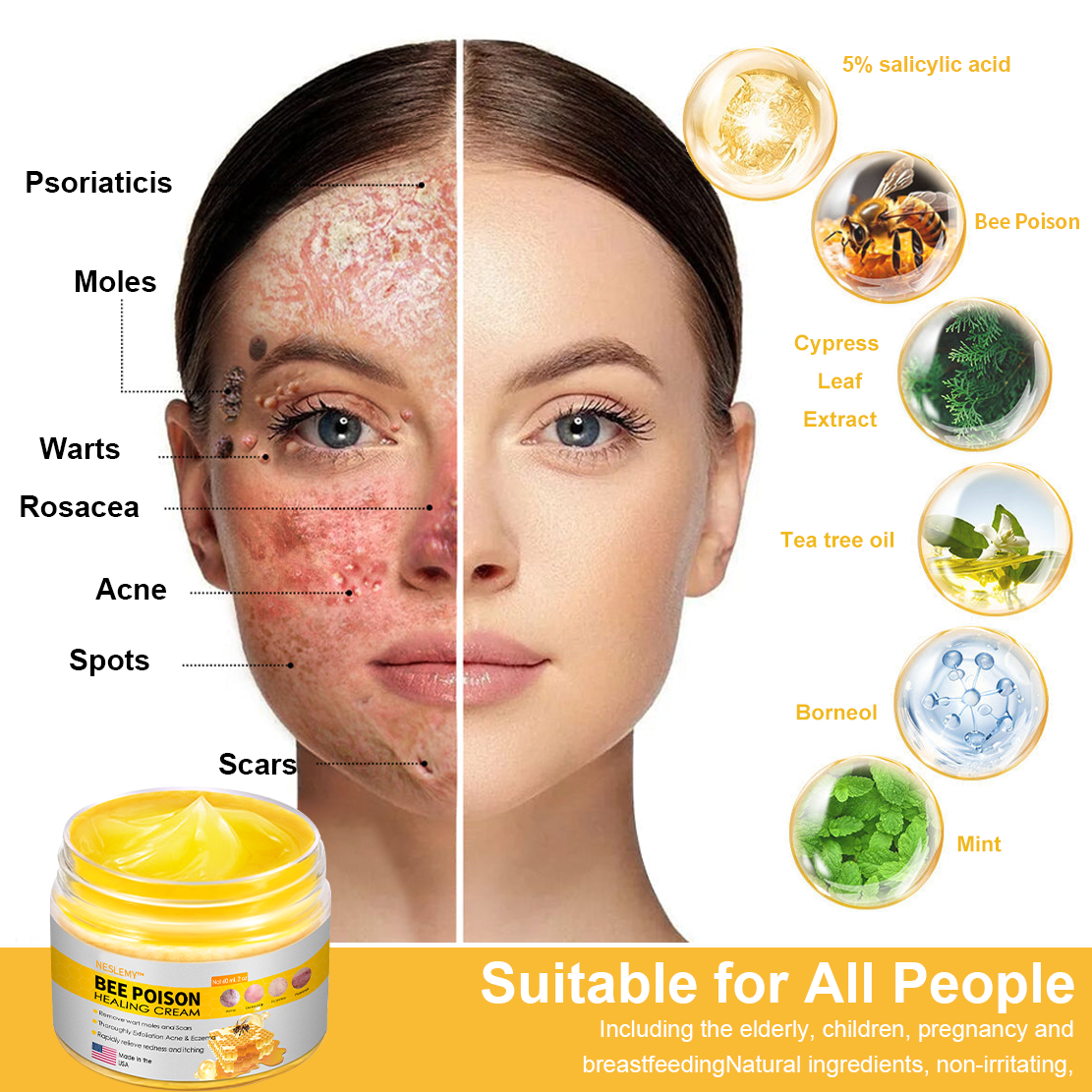 NESLEMY™ Bee Venom Skin Cream(👨⚕AAD Recommended),for Remove Warts, Acne and Scars