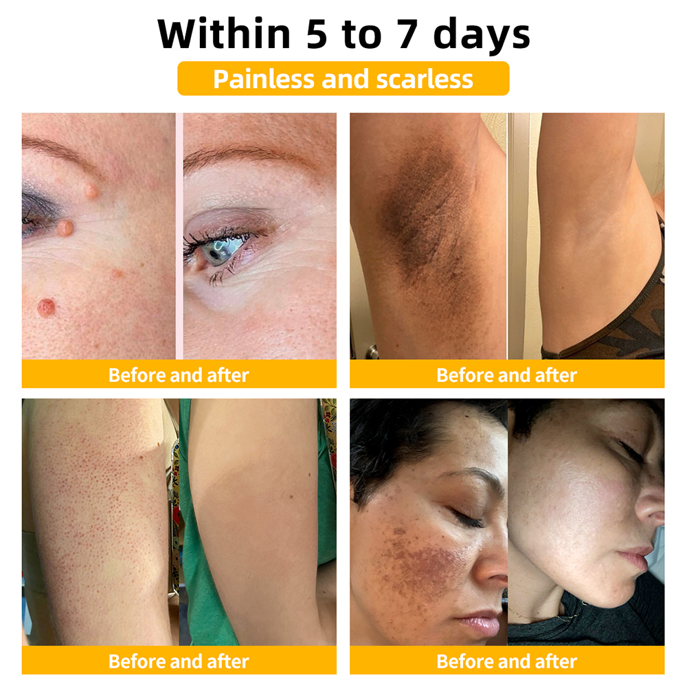 ๐ต๏ธTAILEDENโข Bee poison Skin Treatment Cream๏ผ๐ด๐ด๐ท ๐
๐๐๐๐๐๐๐๐๐๐๏ผ