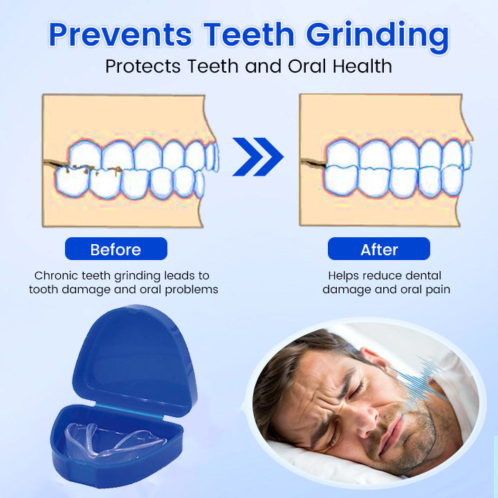Smileasego⢠Anti-Snoring Guard