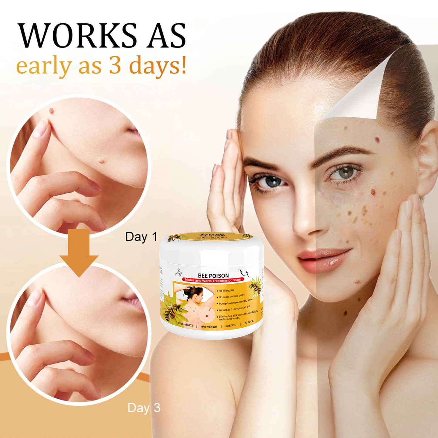 🐝🐝 QIAWI™ BEE POSON MOLE AND WART TREATMENT CREAM(👨⚕AAD RECOMMENDS)
