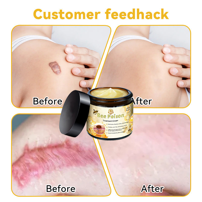 ๐ต๏ธTAILEDENโข Bee poison Skin Treatment Cream๏ผ๐ด๐ด๐ท ๐
๐๐๐๐๐๐๐๐๐๐๏ผ