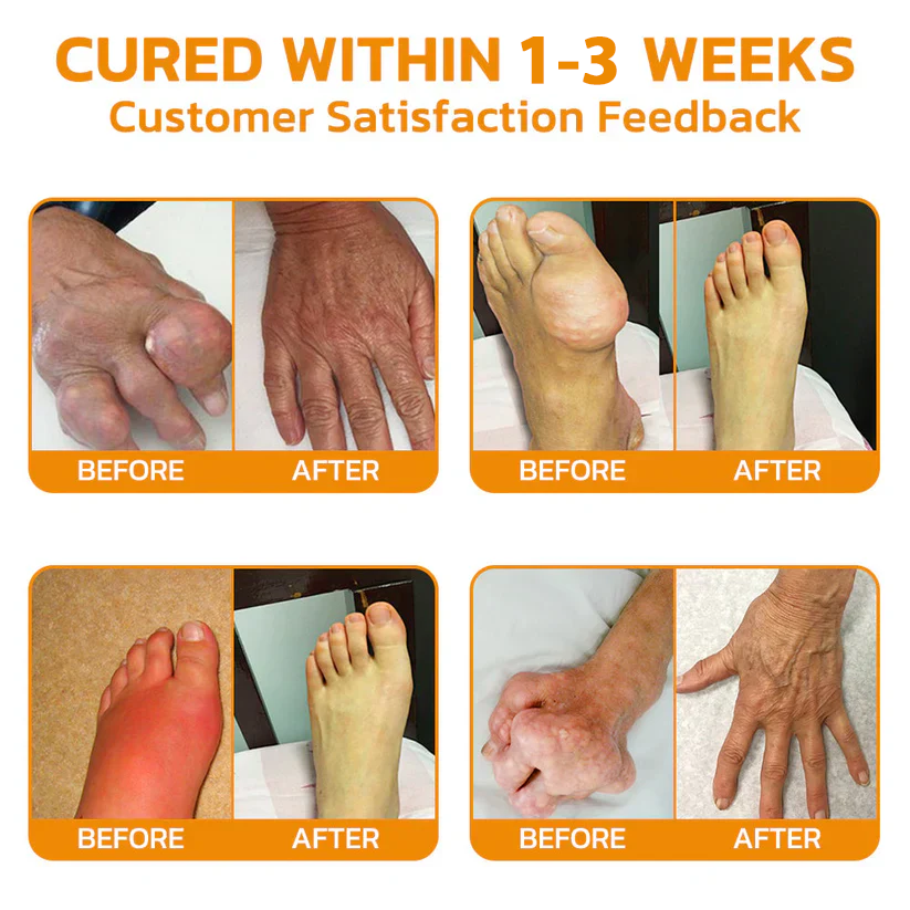 šTAILEDEN⢠Bee Venom Joint Repair GelšØāāļøApproved by the Australian Orthopedic Association (AOA)