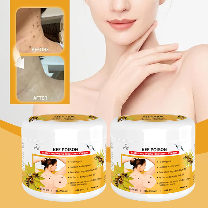 🐝🐝 QIAWI™ BEE POSON MOLE AND WART TREATMENT CREAM(👨⚕AAD RECOMMENDS)
