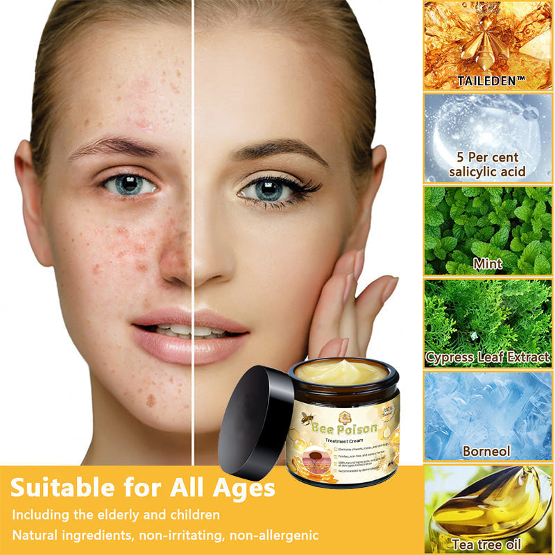 ๐ต๏ธTAILEDENโข Bee poison Skin Treatment Cream๏ผ๐ด๐ด๐ท ๐
๐๐๐๐๐๐๐๐๐๐๏ผ