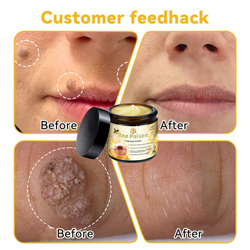 ๐ต๏ธTAILEDENโข Bee poison Skin Treatment Cream๏ผ๐ด๐ด๐ท ๐
๐๐๐๐๐๐๐๐๐๐๏ผ