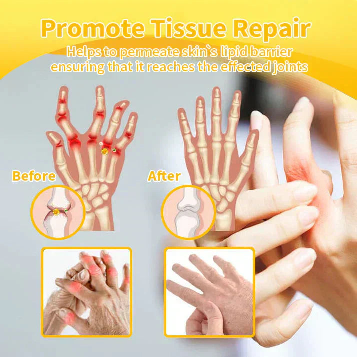 šTAILEDEN⢠Bee Venom Joint Repair GelšØāāļøApproved by the Australian Orthopedic Association (AOA)