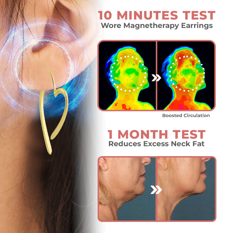 Lymph Flow Magnetogen Earrings🔥LAST DAY SALE-80% OFF🔥