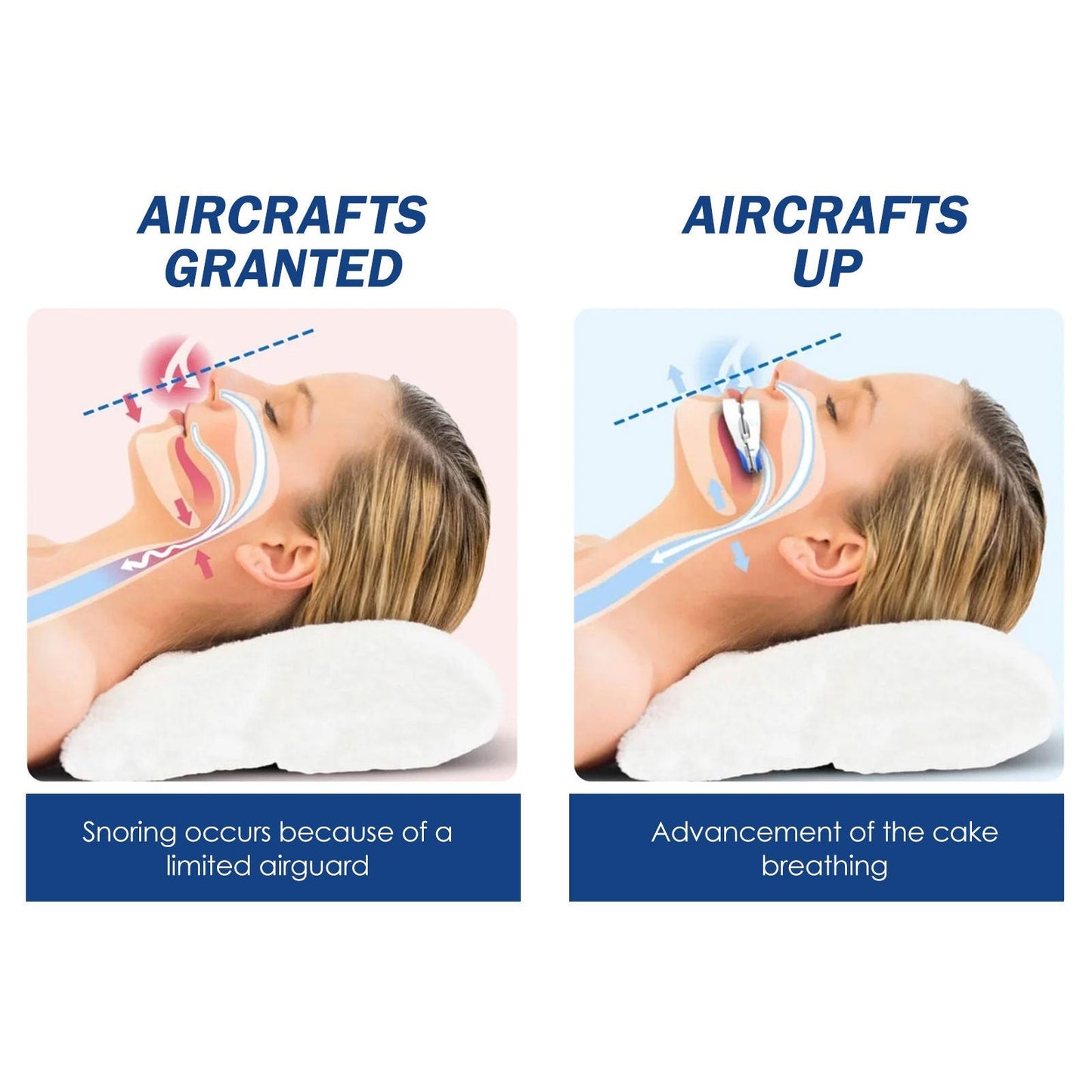 Smileasego⢠Anti-Snoring Guard