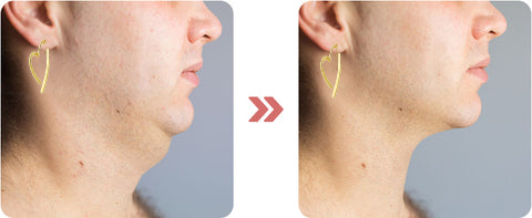 Lymph Flow Magnetogen Earrings🔥LAST DAY SALE-80% OFF🔥