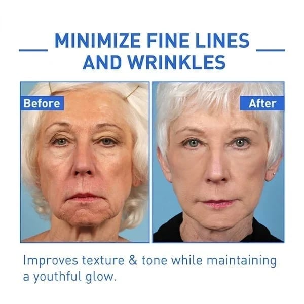 ✨Last Day Promotion 70% OFF - ✨Histone™ Face Serum🔥