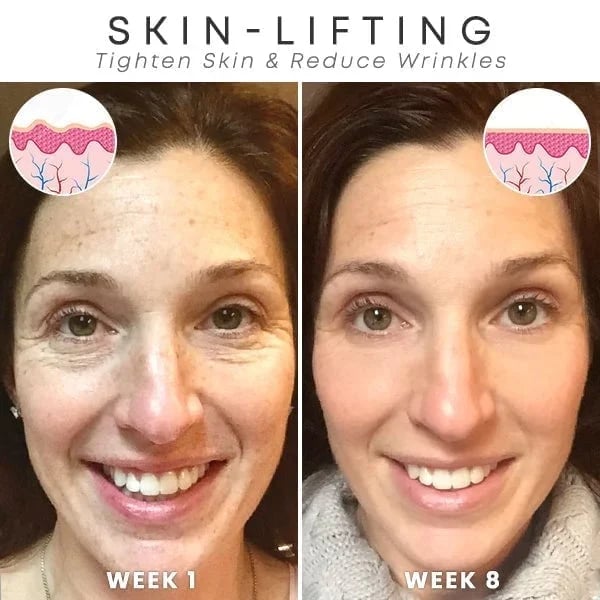 ✨Last Day Promotion 70% OFF - ✨Histone™ Face Serum🔥