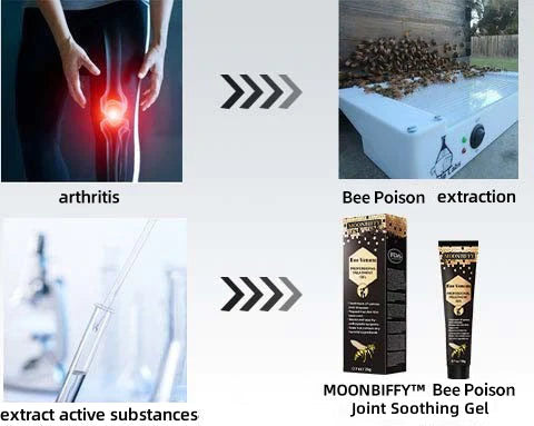 🐝New Zealand Bee Poison Joint Relief Gel