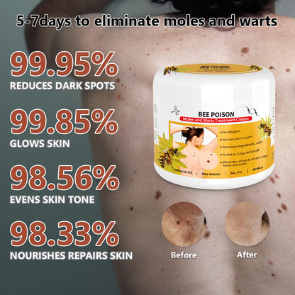 🐝🐝 QIAWI™  BEE POSON MOLE AND WART TREATMENT CREAM(👨‍⚕AAD RECOMMENDS)