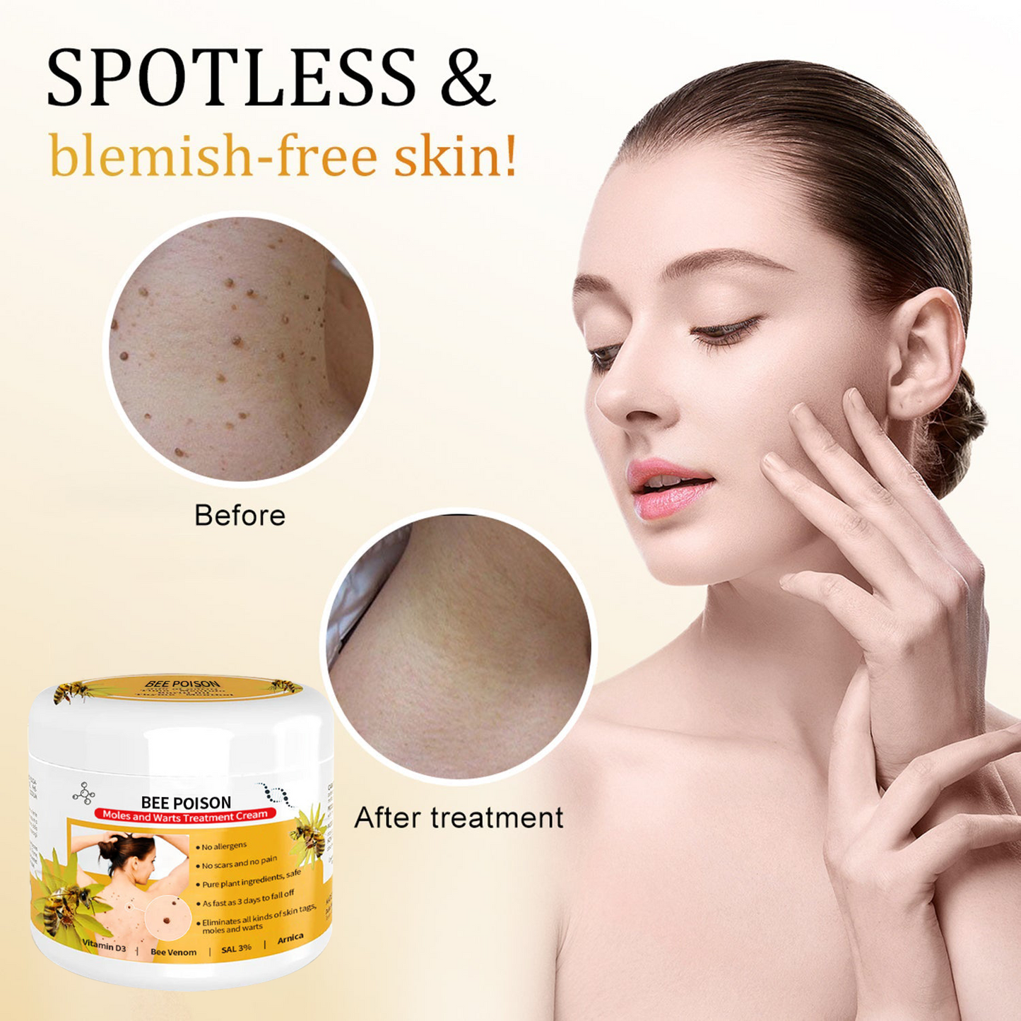 🐝🐝 QIAWI™  BEE POSON MOLE AND WART TREATMENT CREAM(👨‍⚕AAD RECOMMENDS)