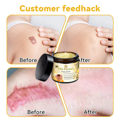 🏵️TAILEDEN™ Bee poison Skin Treatment Cream（𝐴𝐴𝐷 𝑅𝑒𝑐𝑜𝑚𝑚𝑒𝑛𝑑𝑒𝑑）
