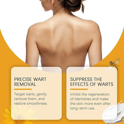 🐝🐝 QIAWI™  BEE POSON MOLE AND WART TREATMENT CREAM(👨‍⚕AAD RECOMMENDS)