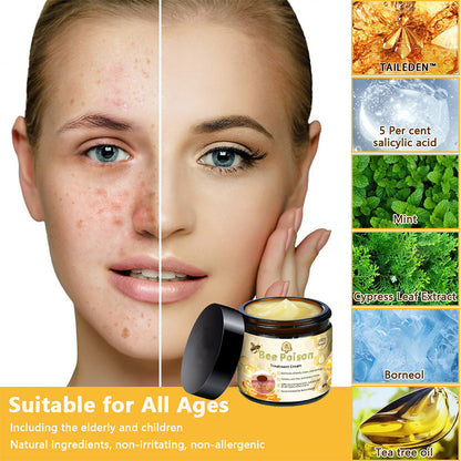 🏵️TAILEDEN™ Bee poison Skin Treatment Cream（𝐴𝐴𝐷 𝑅𝑒𝑐𝑜𝑚𝑚𝑒𝑛𝑑𝑒𝑑）