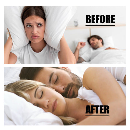 Smileasego™ Anti-Snoring Guard