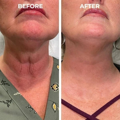✨Last Day Promotion 70% OFF - ✨Histone™ Face Serum🔥