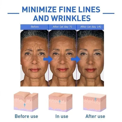 ✨Last Day Promotion 70% OFF - ✨Histone™ Face Serum🔥